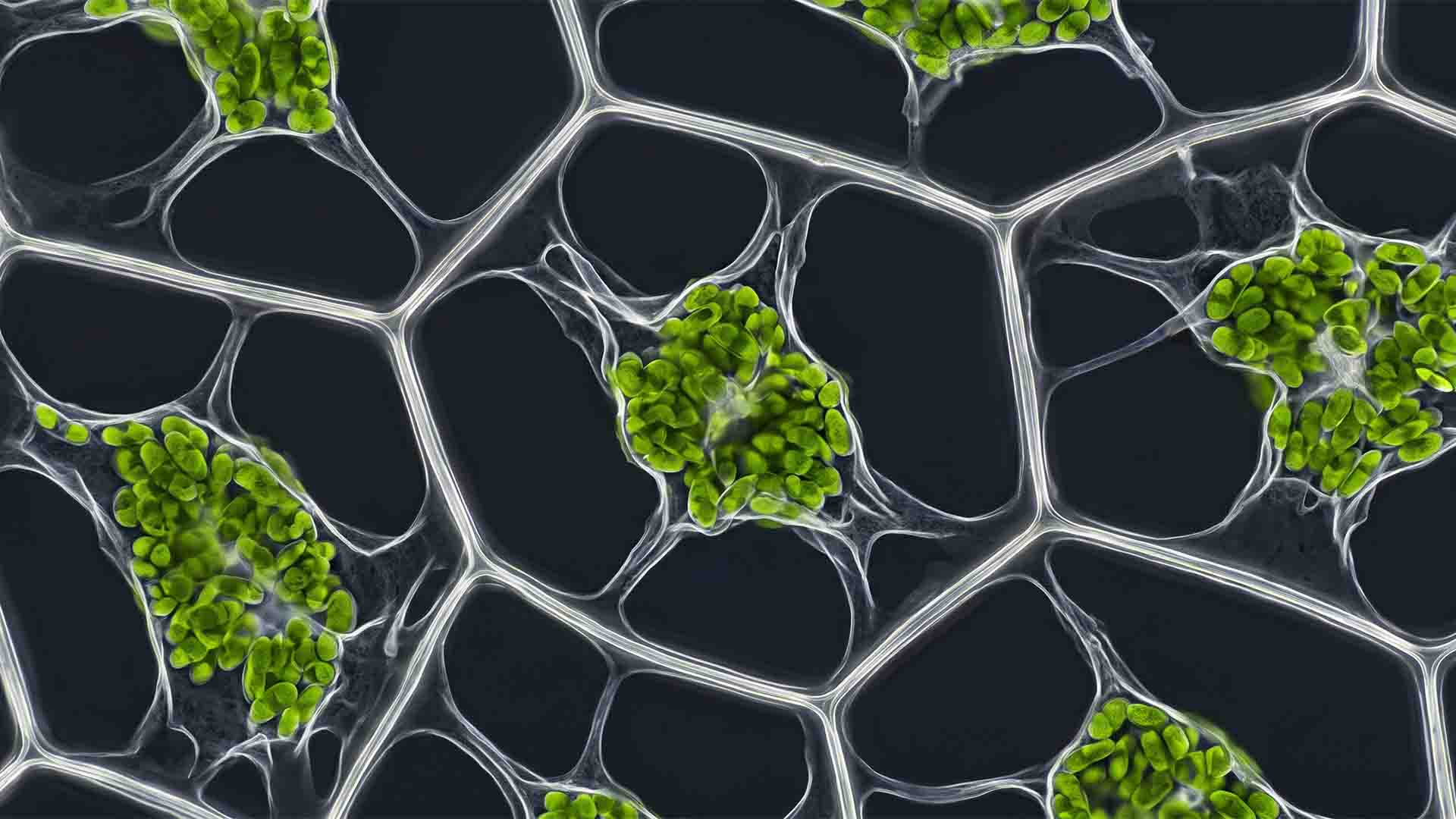 Microscopic view of freshwater aquarium plant cells undergoing osmotic plasmolysis and vacuole shrinkage from aquarium salt.